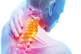 Síntomas da osteocondrose e das regras nutricionais para a enfermidade