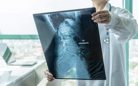 A radiografía é un método de diagnóstico necesario se as costas doen